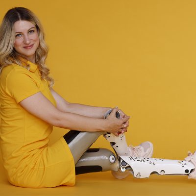 Moda Inclusiva: ainda dá tempo de participar do concurso que valoriza a diversidade na moda